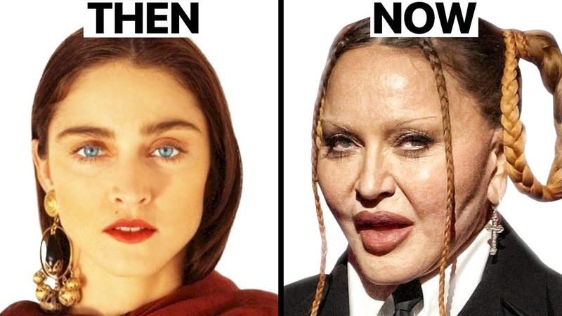Madonna Plastic Surgeries Surgeon
