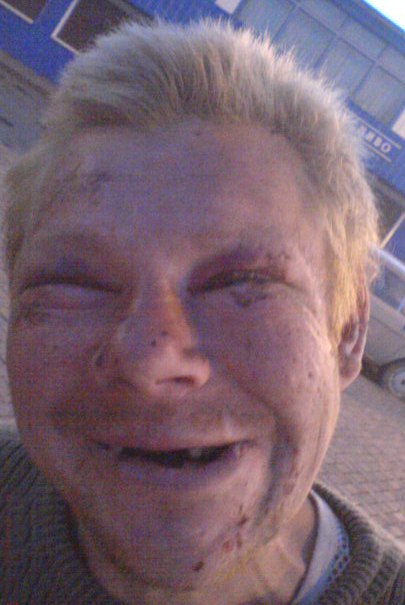 Gomer Simpson | Киев