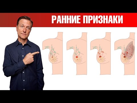 6 ранних признаков рака