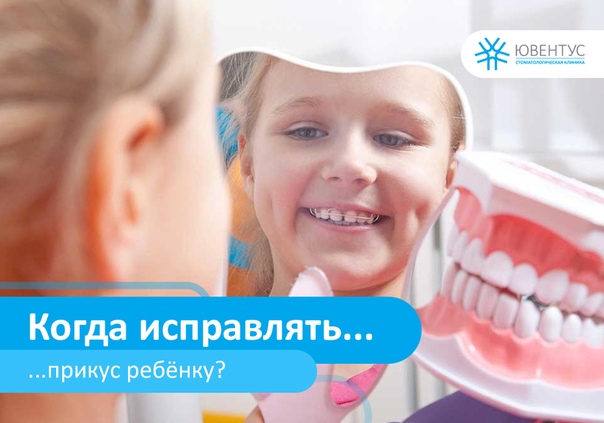 брекеты для выравнивания зубов. ребенок улыбается. лечить прикус у ребенка. открытый дистальный прикус. лечить прикус у ребенка.