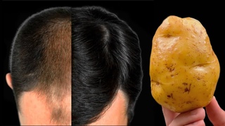 🤩Haare wachsen wie verrückt und fallen nicht aus! Dies ist das wirksamste Mittel